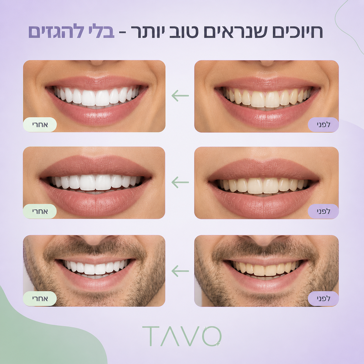 סרום להלבנת שיניים של TAVO
