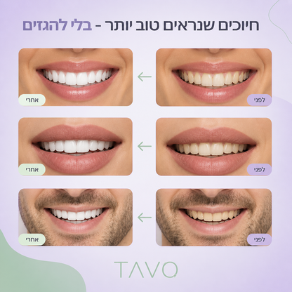 סרום להלבנת שיניים של TAVO